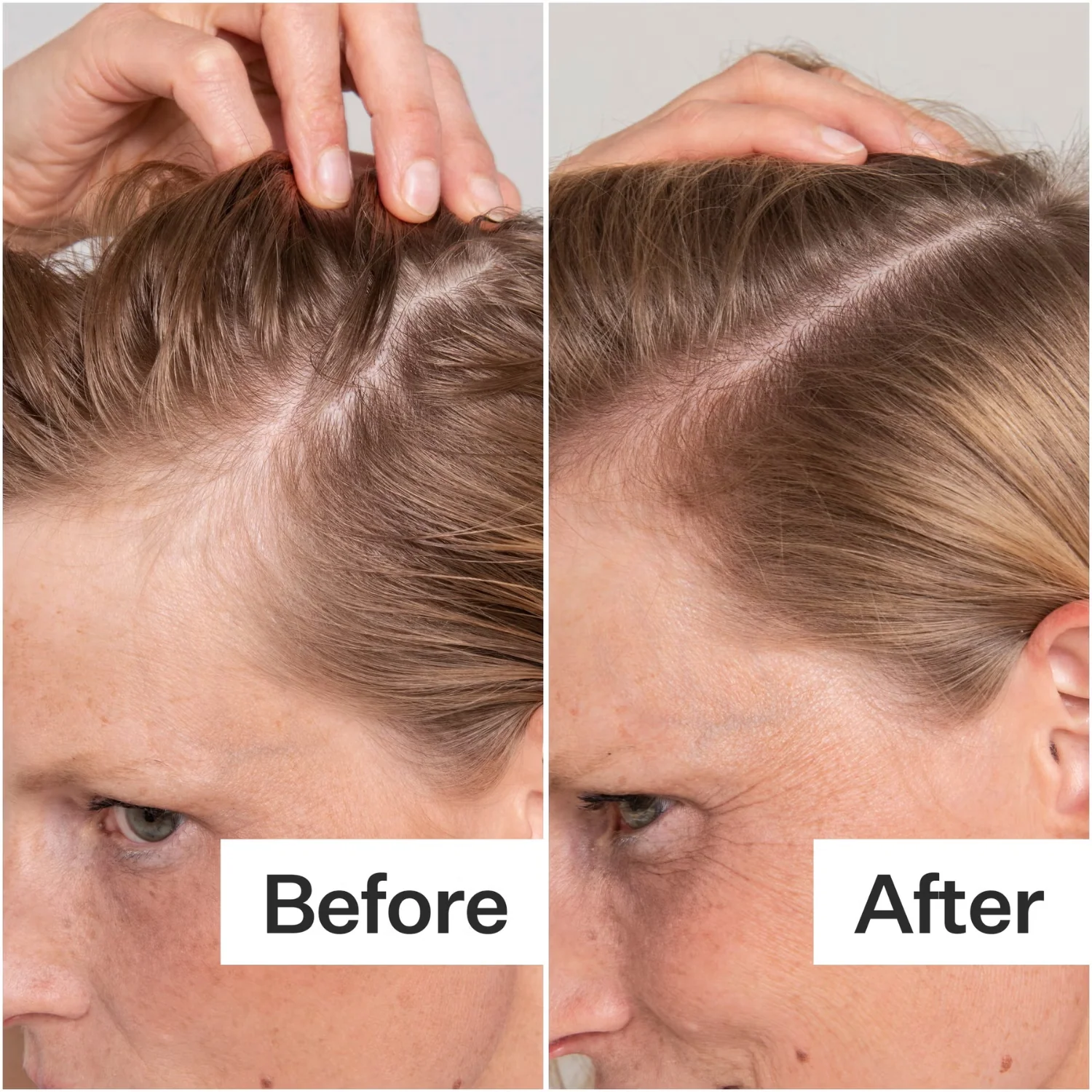 Act+Acre | Cold Processed Scalp Renew 60ml - Image 3