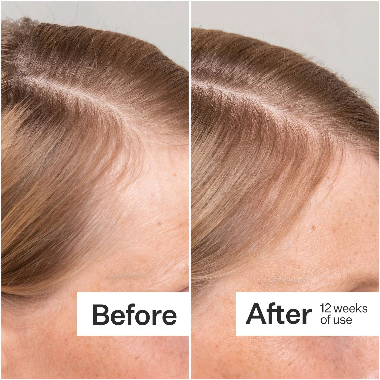 Act+Acre | Stem Cell Scalp Serum 65ml - Image 5