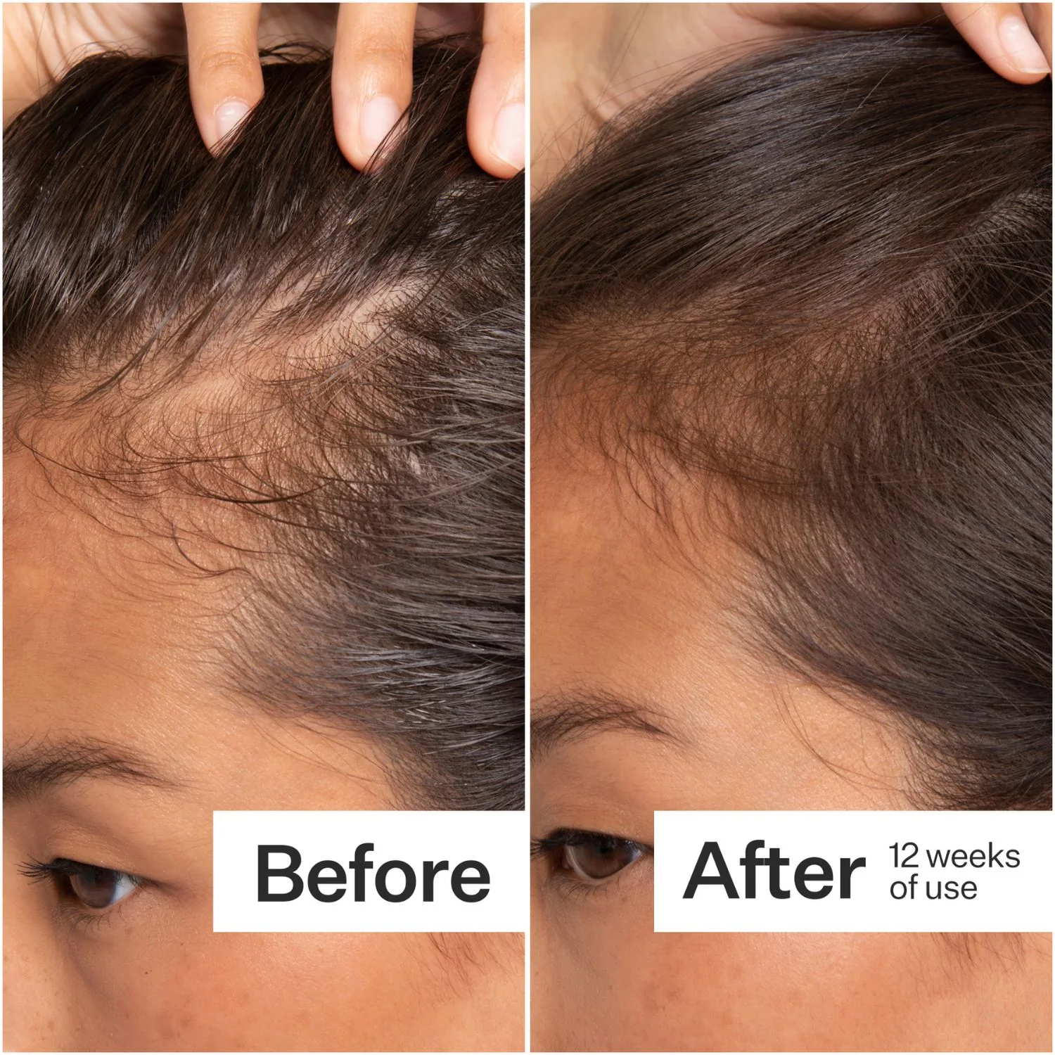 Act+Acre | Stem Cell Scalp Serum 65ml - Image 6