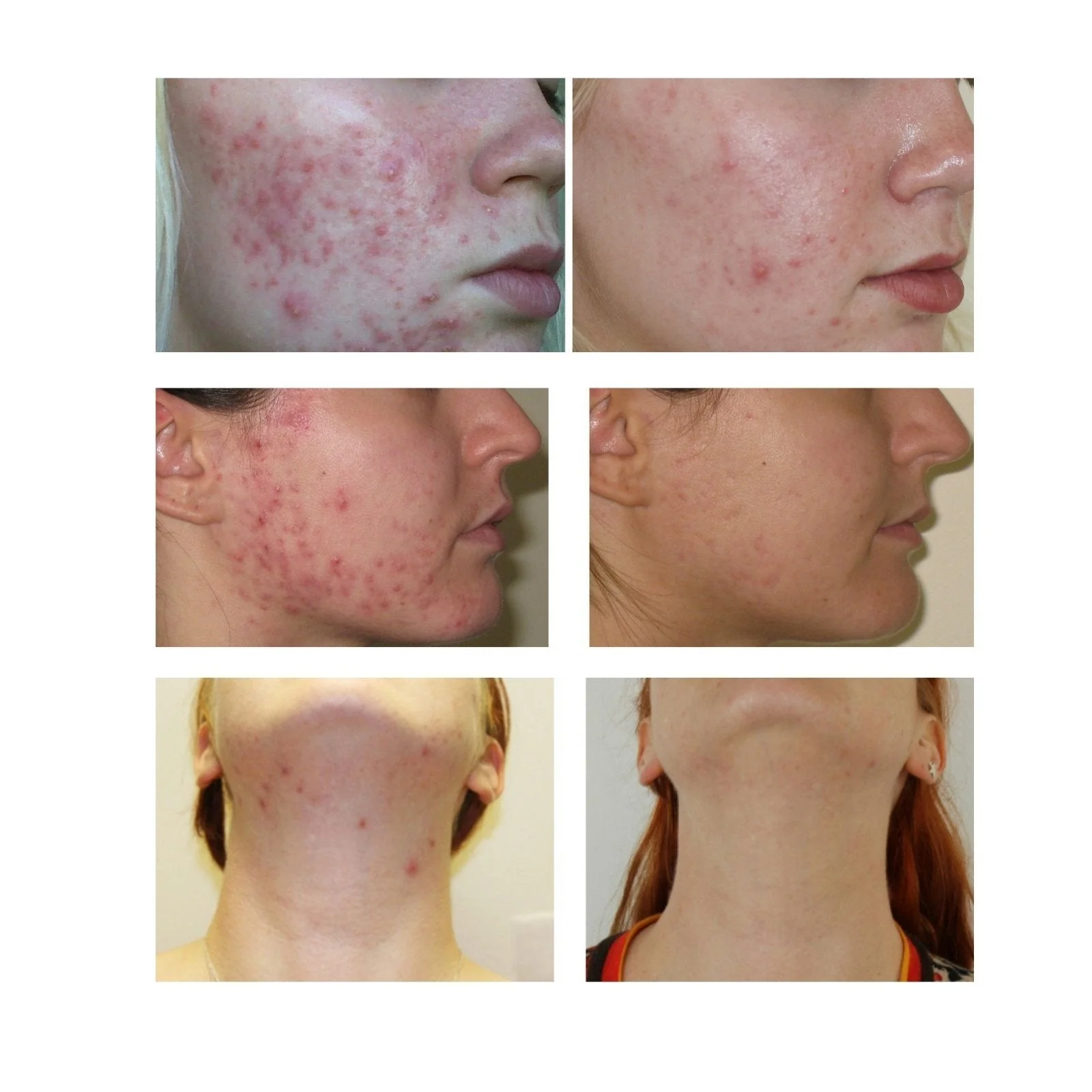 Advanced Nutrition Programme Skin Accumax 120 caps - Image 6