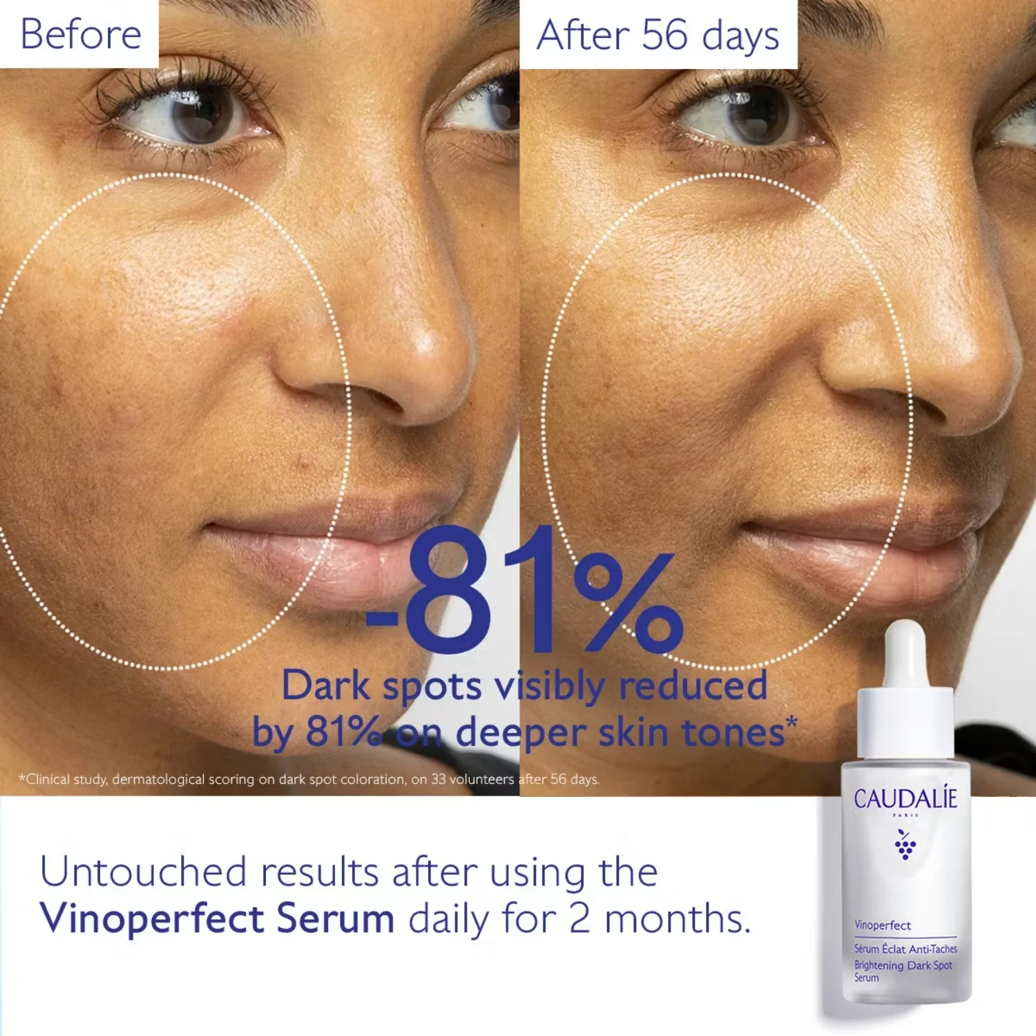 Caudalie | Vinoperfect Dark Spot Brightening Serum 50ml - Jumbo Size - Image 3