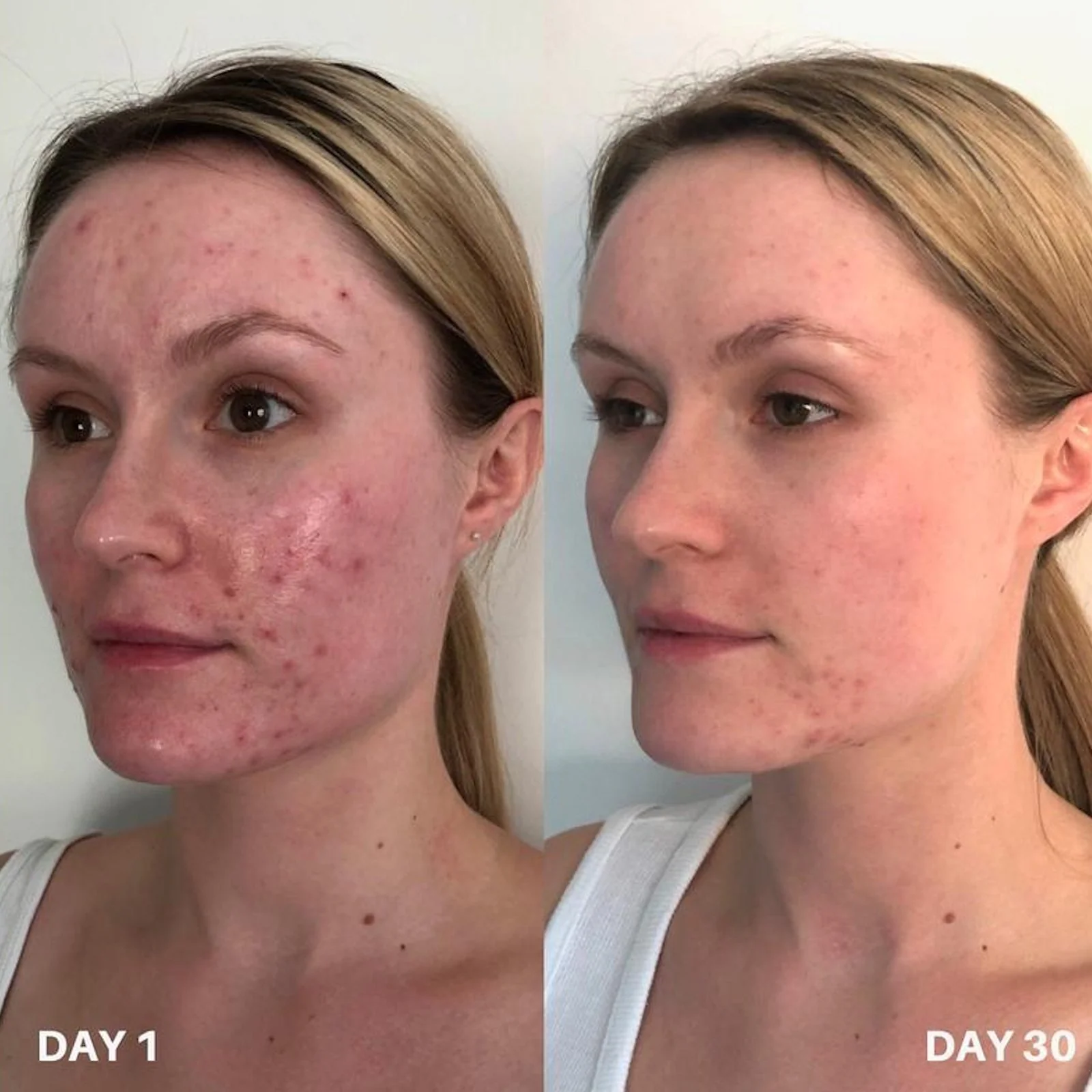 Clinisoothe+ | Skin Purifier 250ml - Image 2