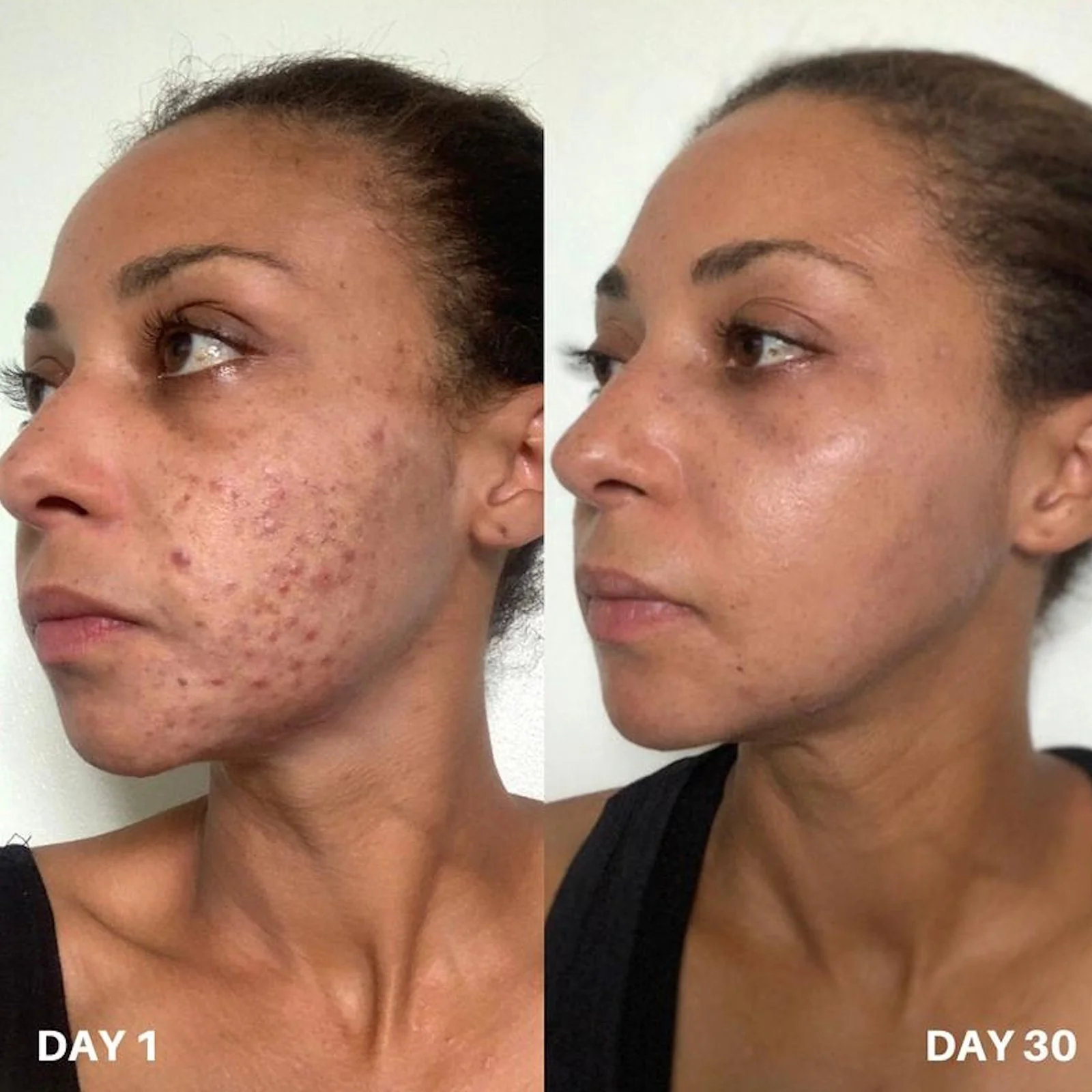 Clinisoothe+ | Skin Purifier 250ml - Image 3