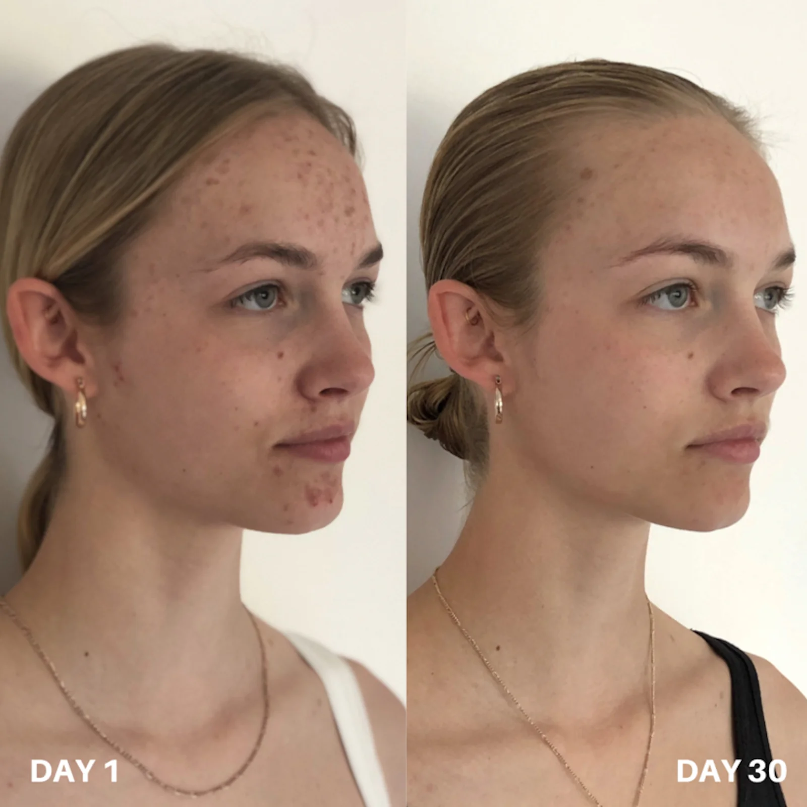 Clinisoothe+ | Skin Purifier 250ml - Image 4