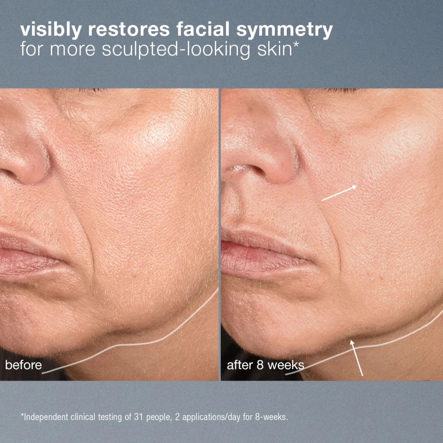 Dermalogica | Neurotouch Symmetry Serum 30ml - Image 3
