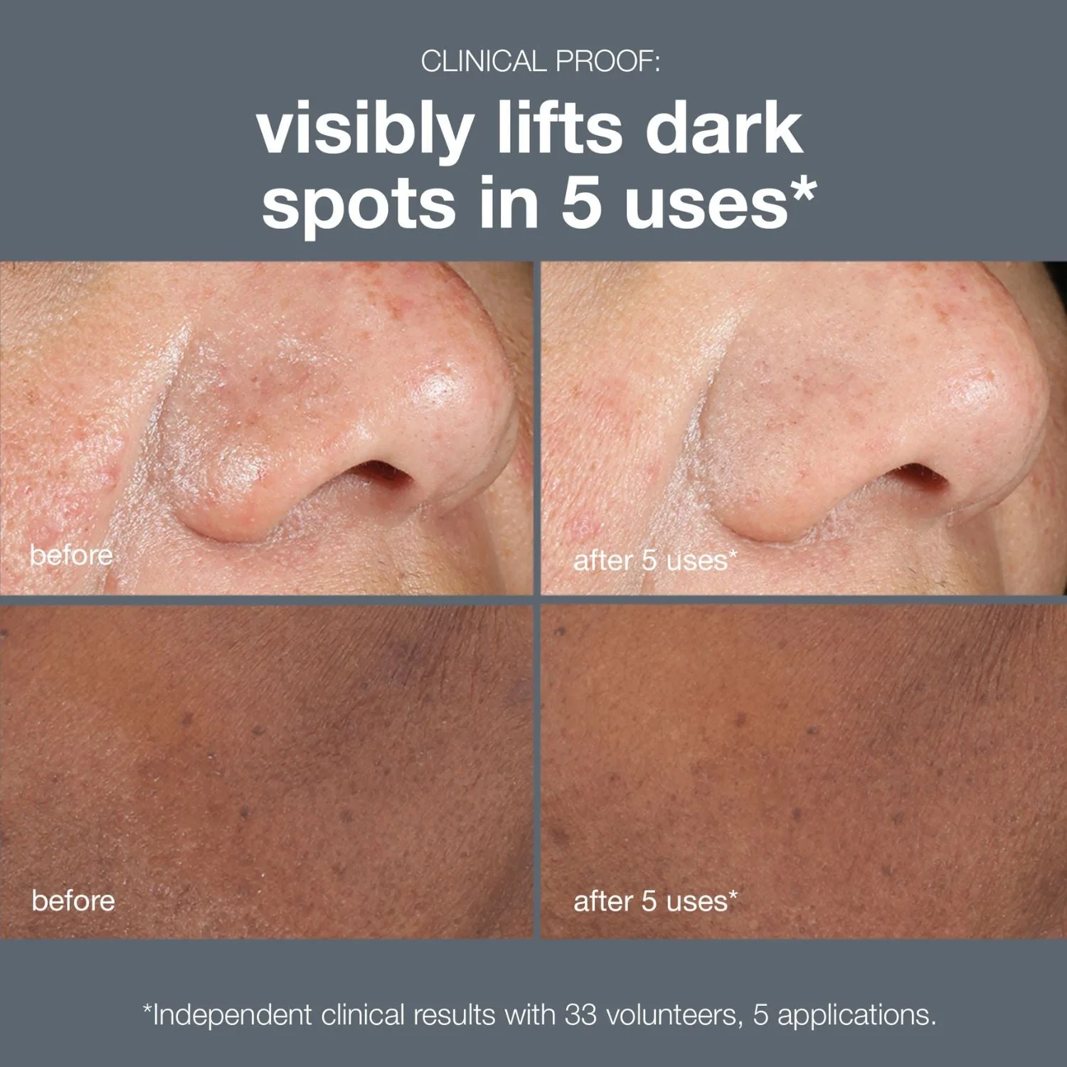 Dermalogica | PowerBright Dark Spot Peel 50ml - Image 4