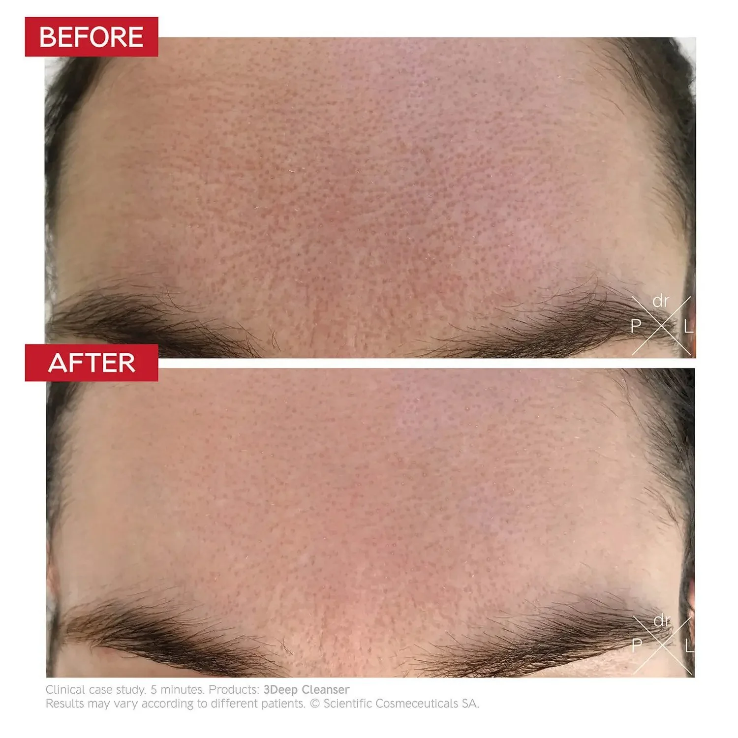 Dr LEVY Switzerland | 3Deep Cell Renewal Micro-Resurfacing Cleanser 150ml - Image 6