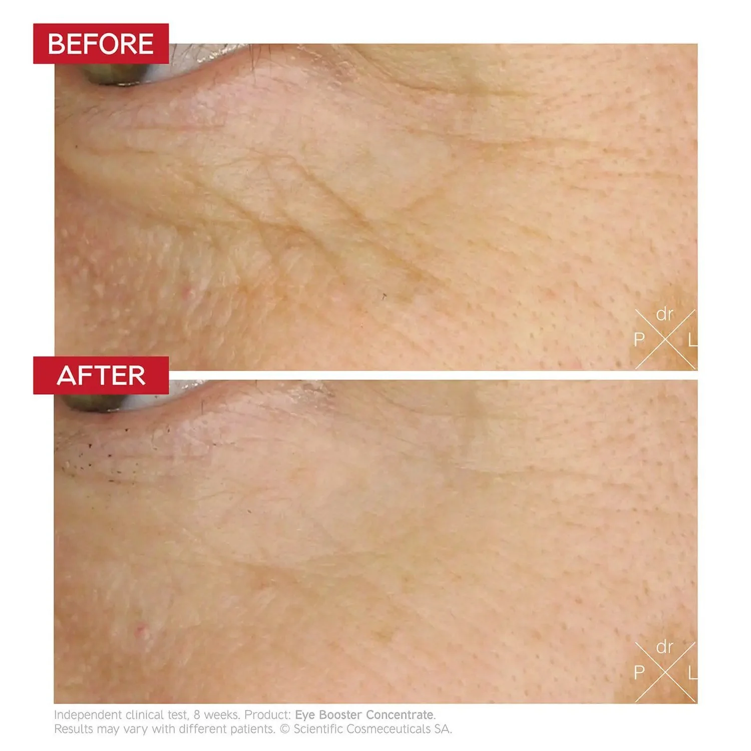 Dr LEVY Switzerland Eye Booster Concentrate 15ml - Image 6