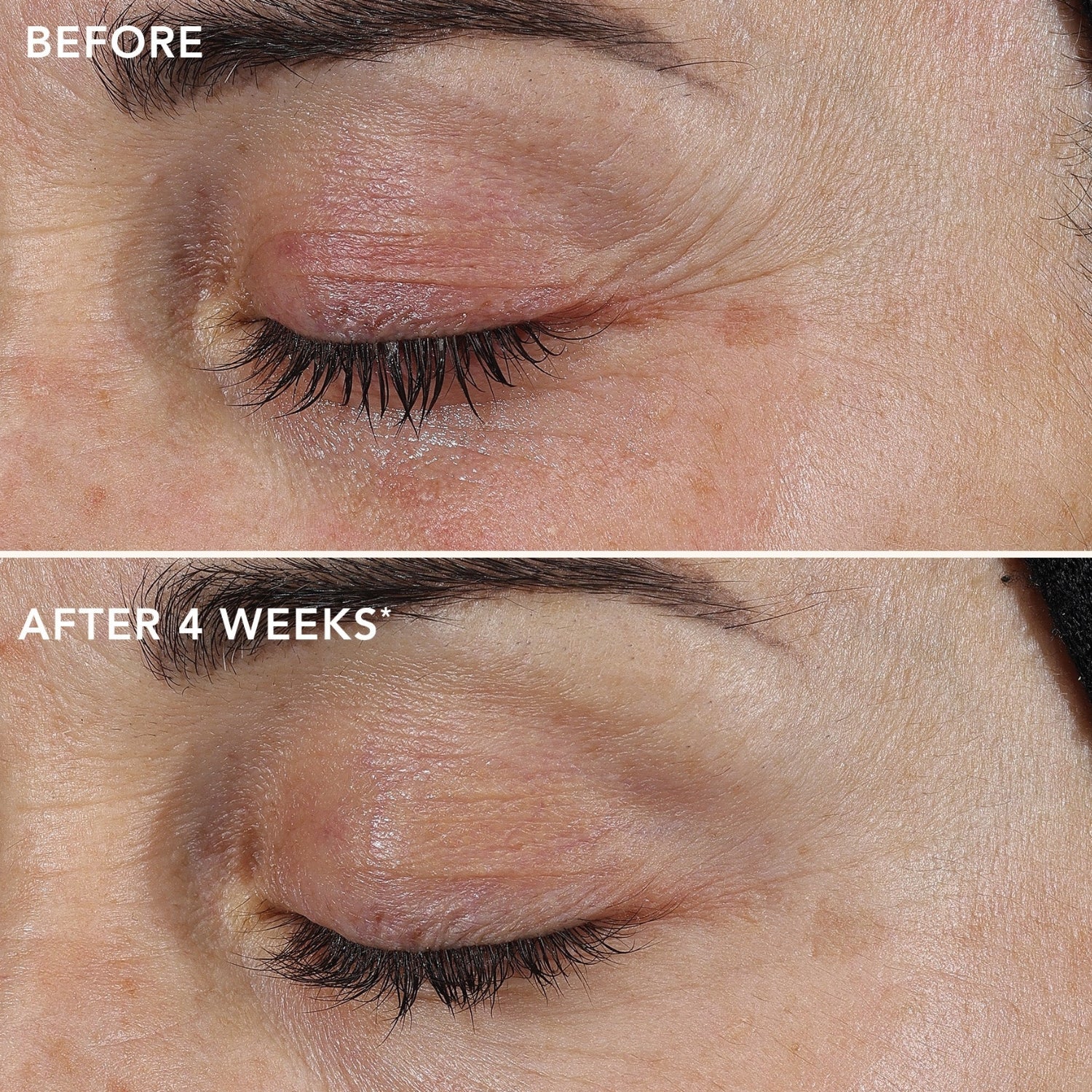 Image Skincare | AGELESS+ Retinol Repair Cream 0.3% Retinol Complex 50ml - Image 2