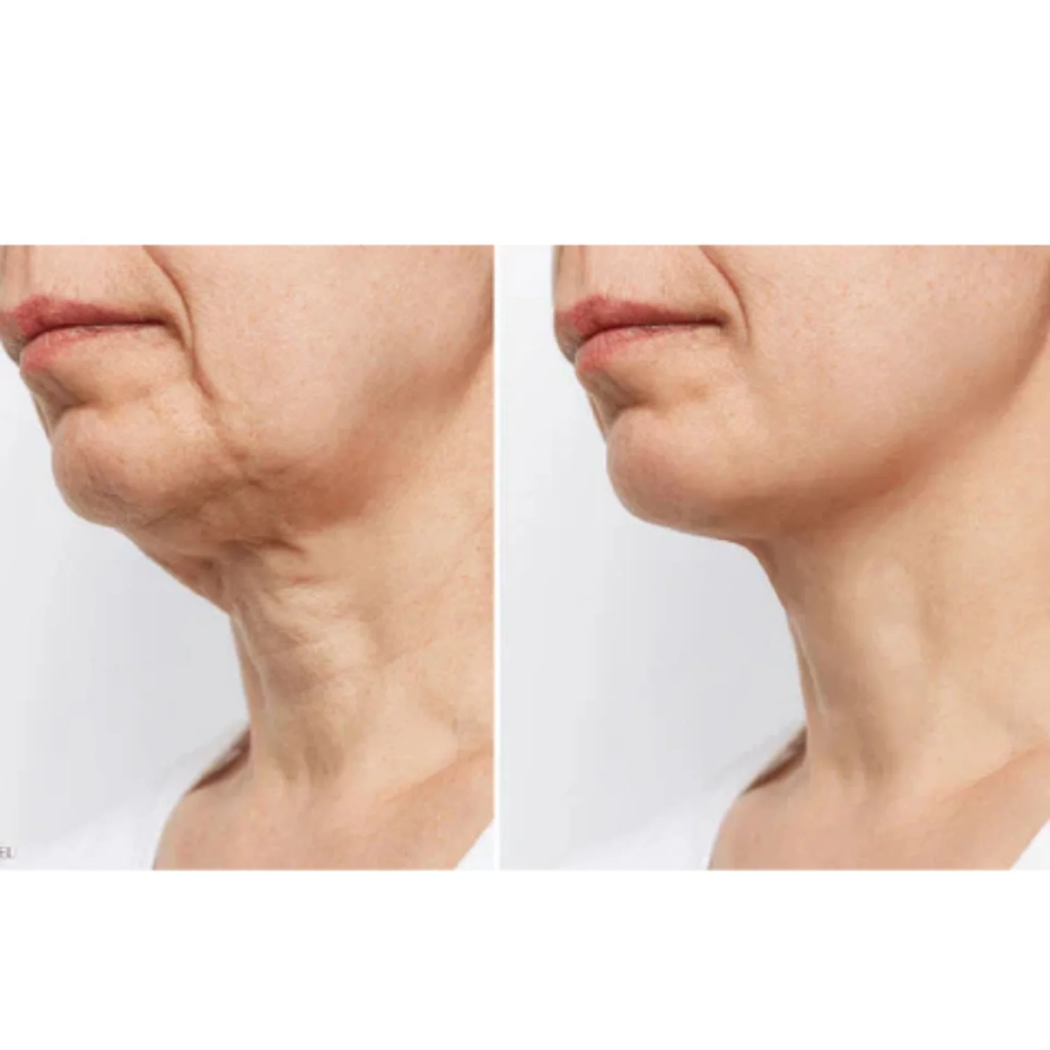 iS Clinical | Neck Perfect Complex 50g - Image 3