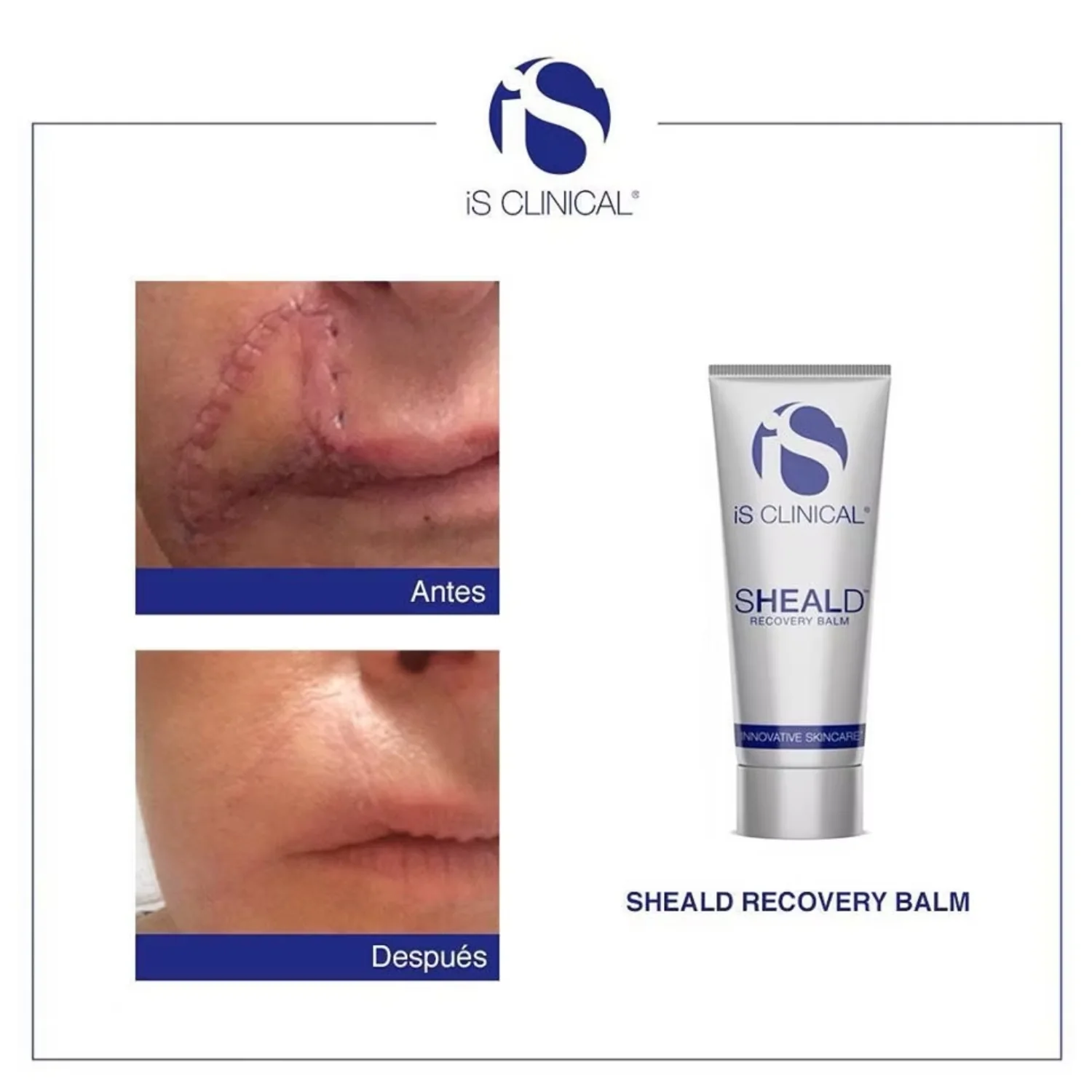 iS Clinical | SHEALD Recovery Balm 60g - Image 2