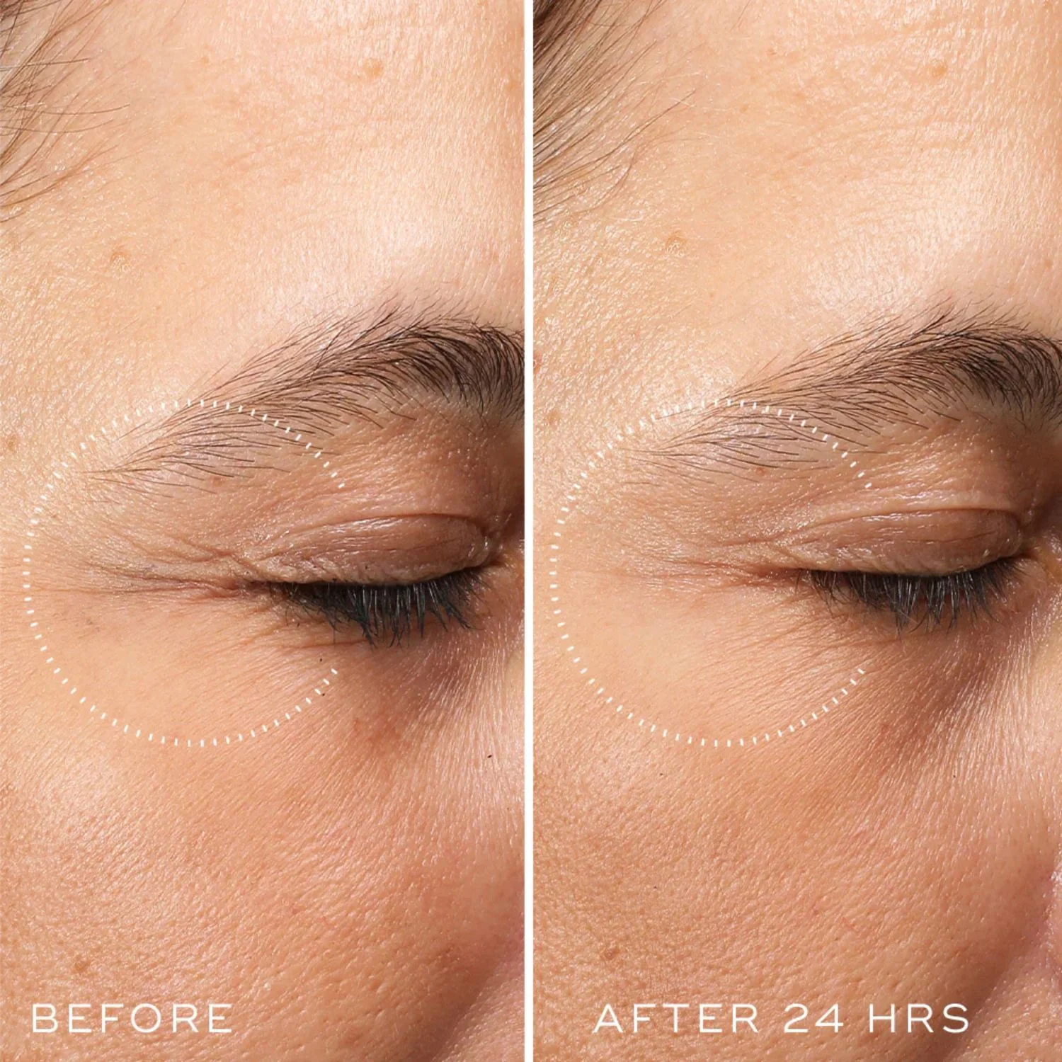 Medik8 | Crystal Retinal Ceramide Eye 3 15ml - Image 2