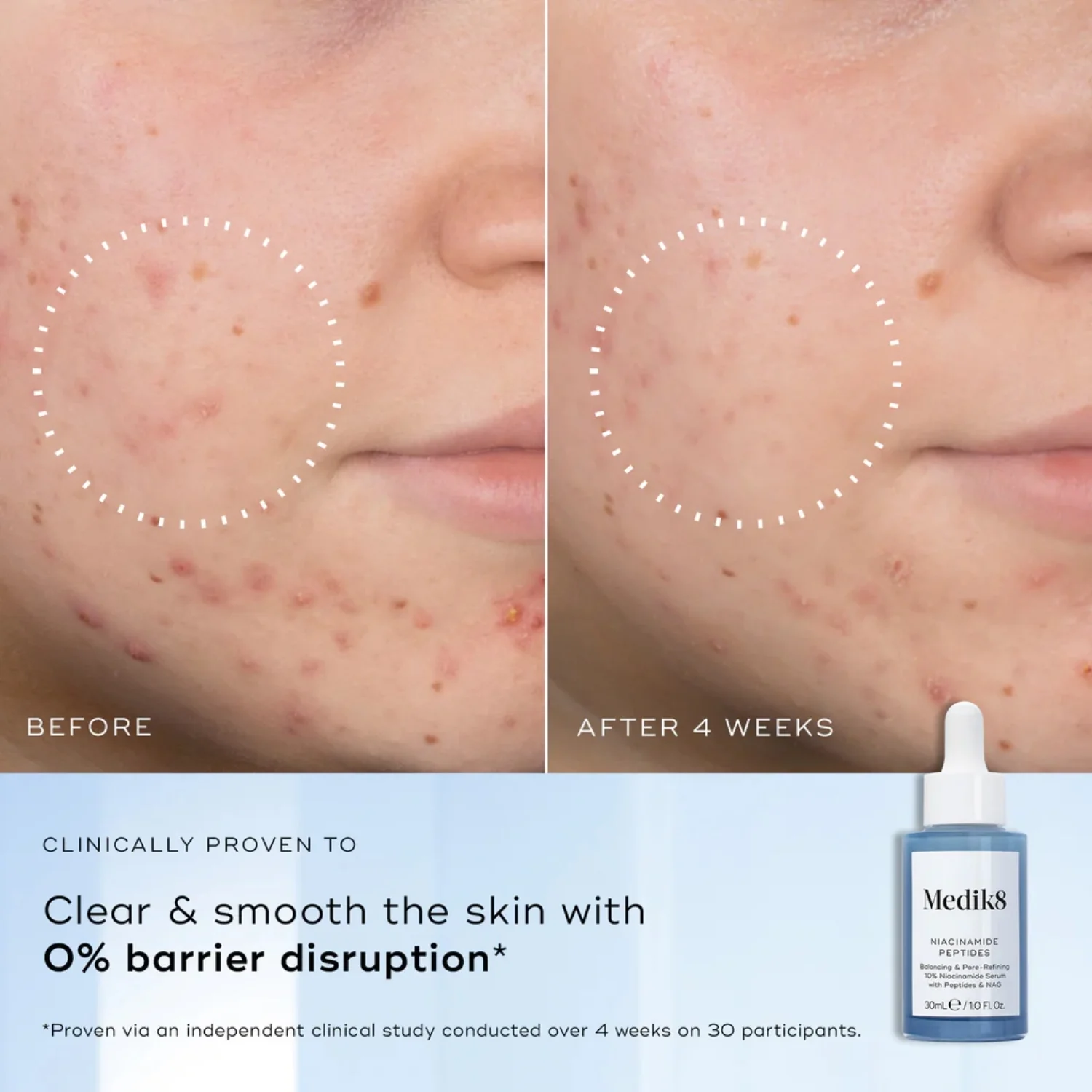 Medik8 Niacinamide Peptides 30ml - Image 8