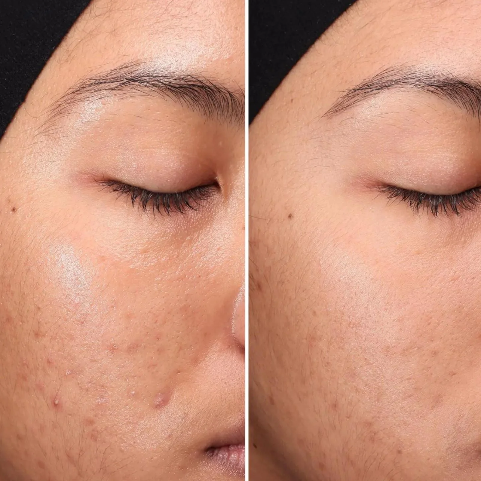 Medik8 | Press & Clear 150ml - Image 6