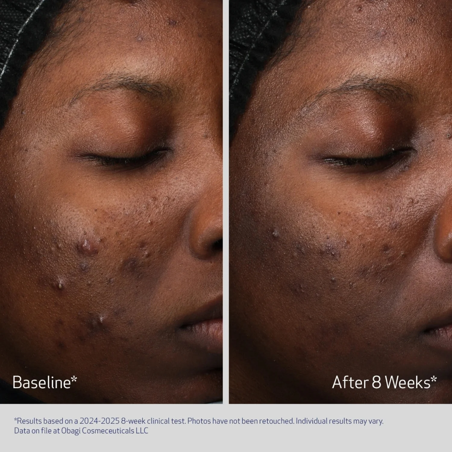 Obagi | Retinol + PHA Refining Night Cream 50ml - Image 2