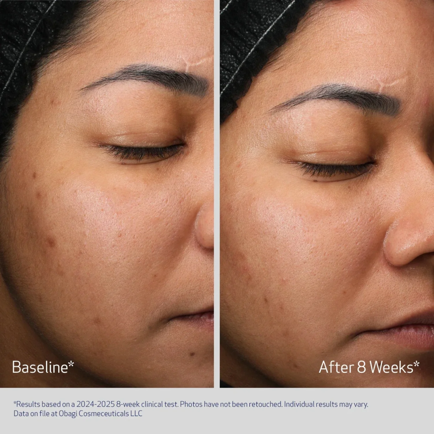 Obagi | Retinol + PHA Refining Night Cream 50ml - Image 4