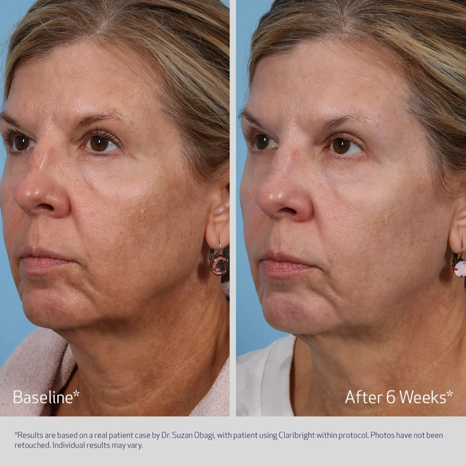 Obagi | SuzanObagiMD Claribright 50 ml - Image 2