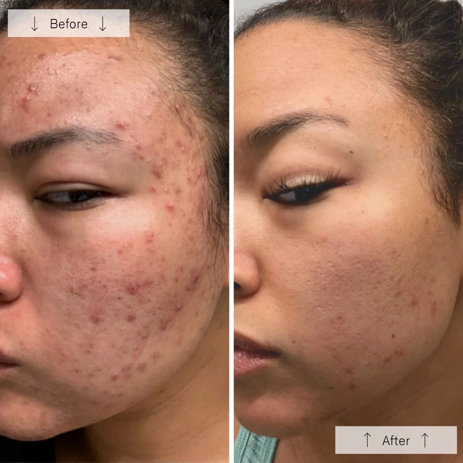 Omnilux | Clear Face Mask - Image 2