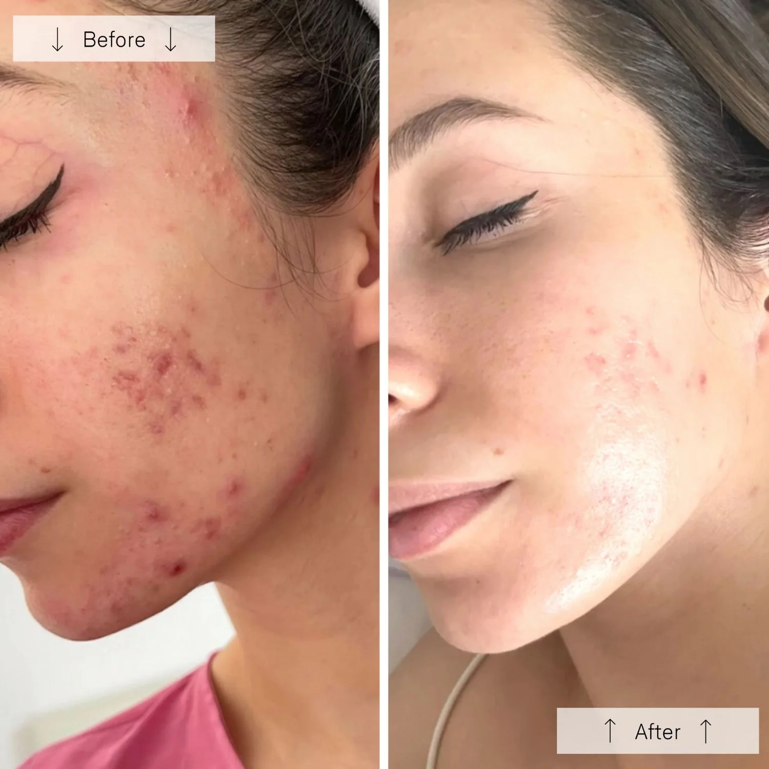 Omnilux | Clear Face Mask - Image 5