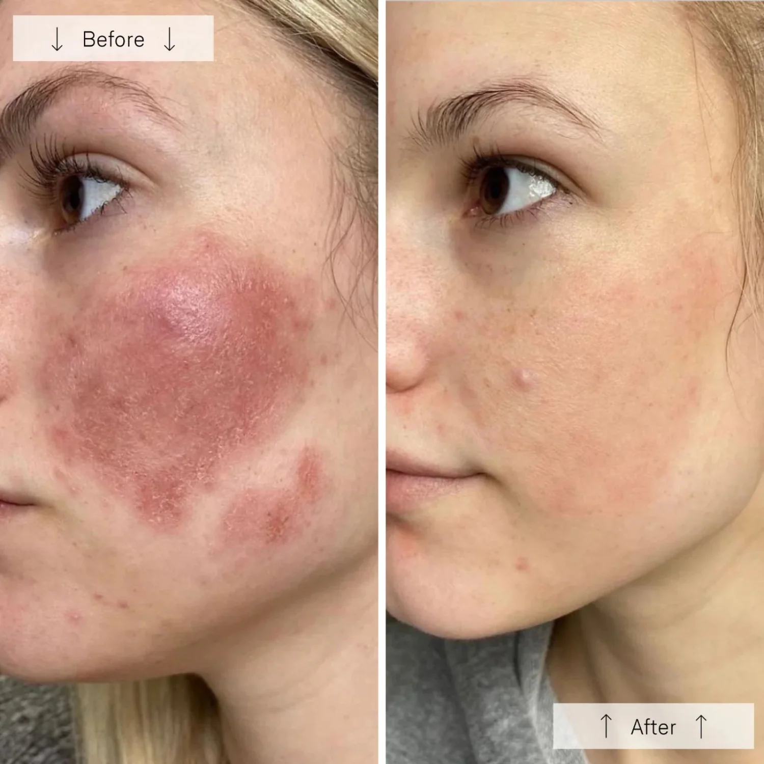 Omnilux Contour Face Mask - Image 2