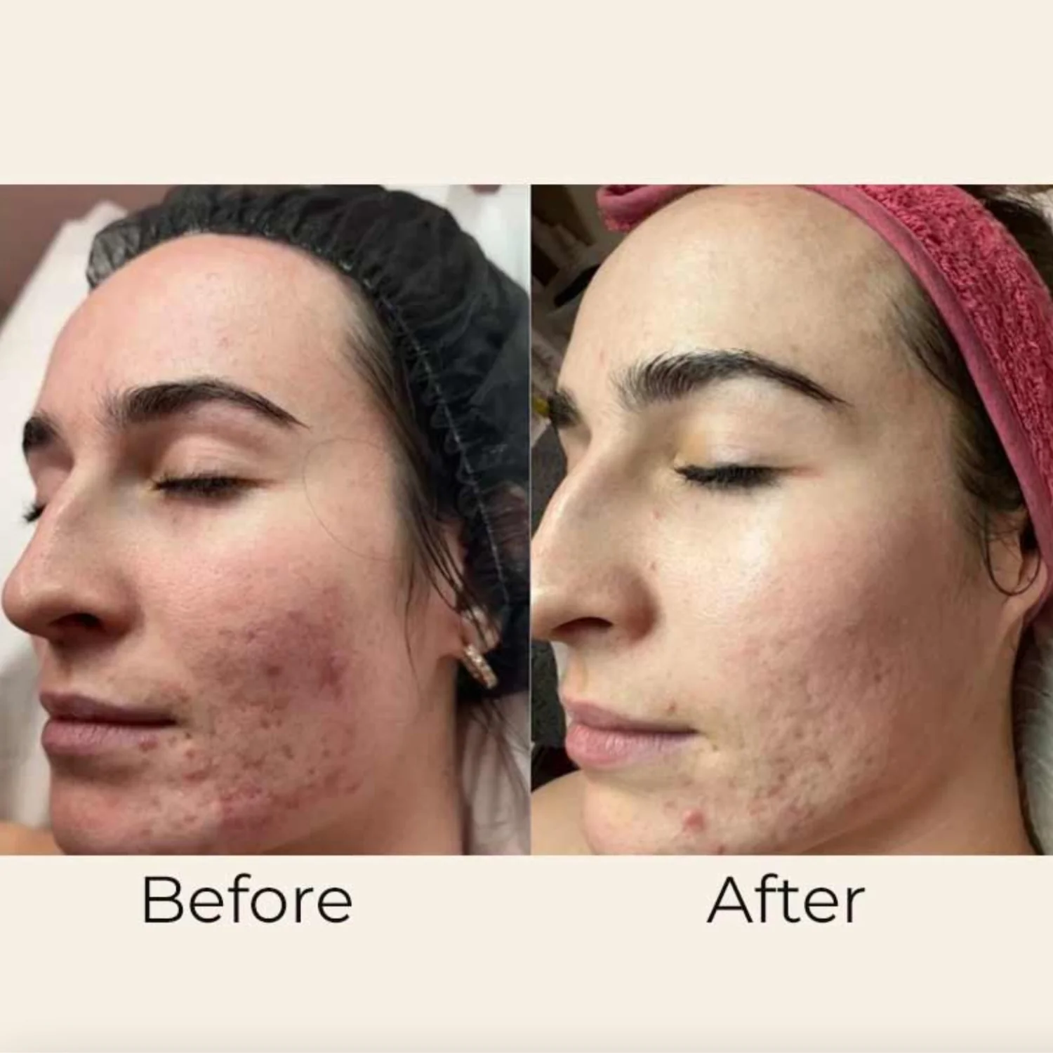 Skin Formuals | Vitamin A Restore Serum 30ml - Image 3