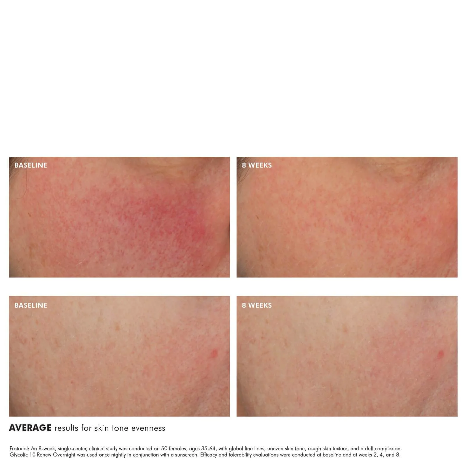 SkinCeuticals Glycolic 10 Renew Overnight 50ml - Image 5