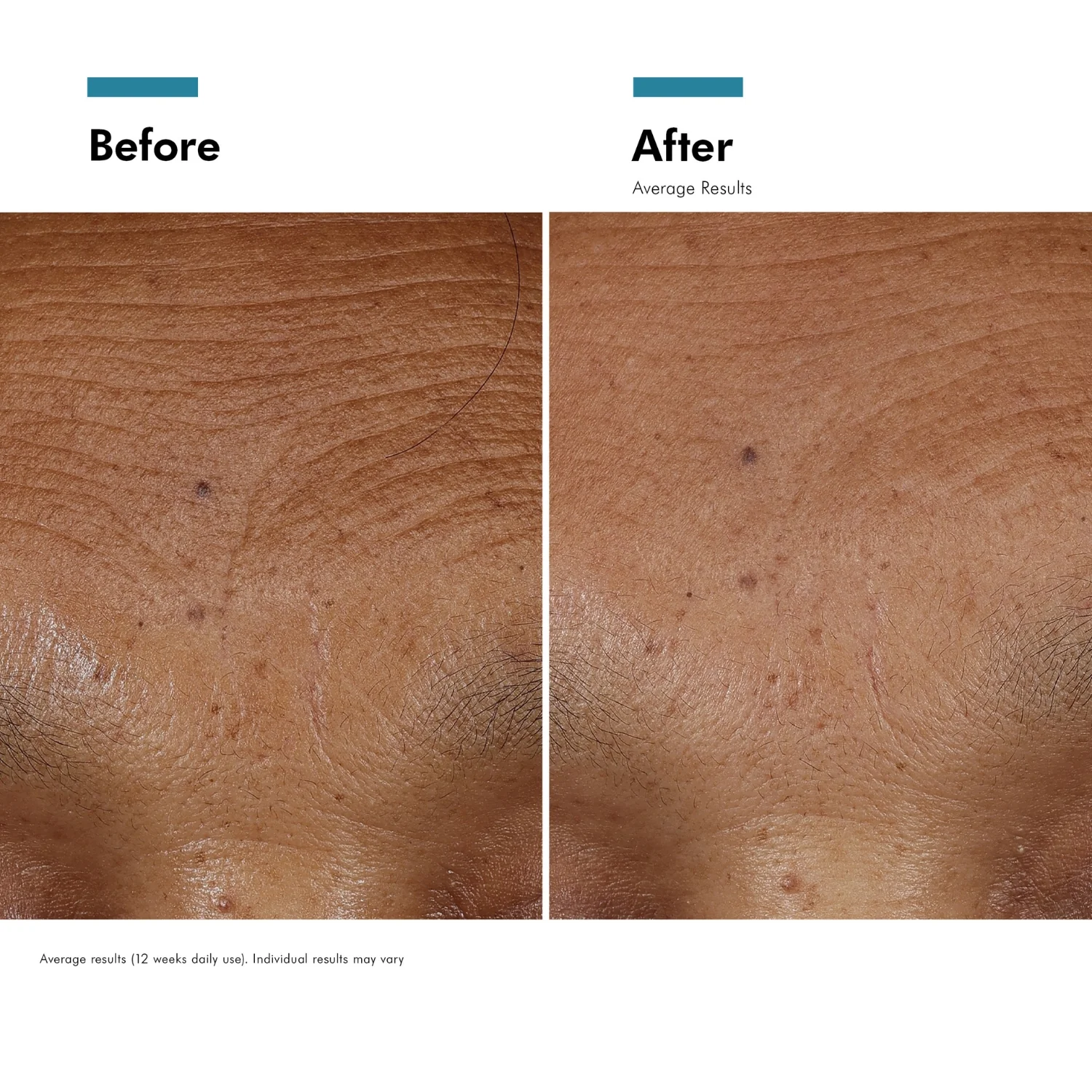 SkinCeuticals HA Intensifier Multi-Glycan 30ml - Image 2