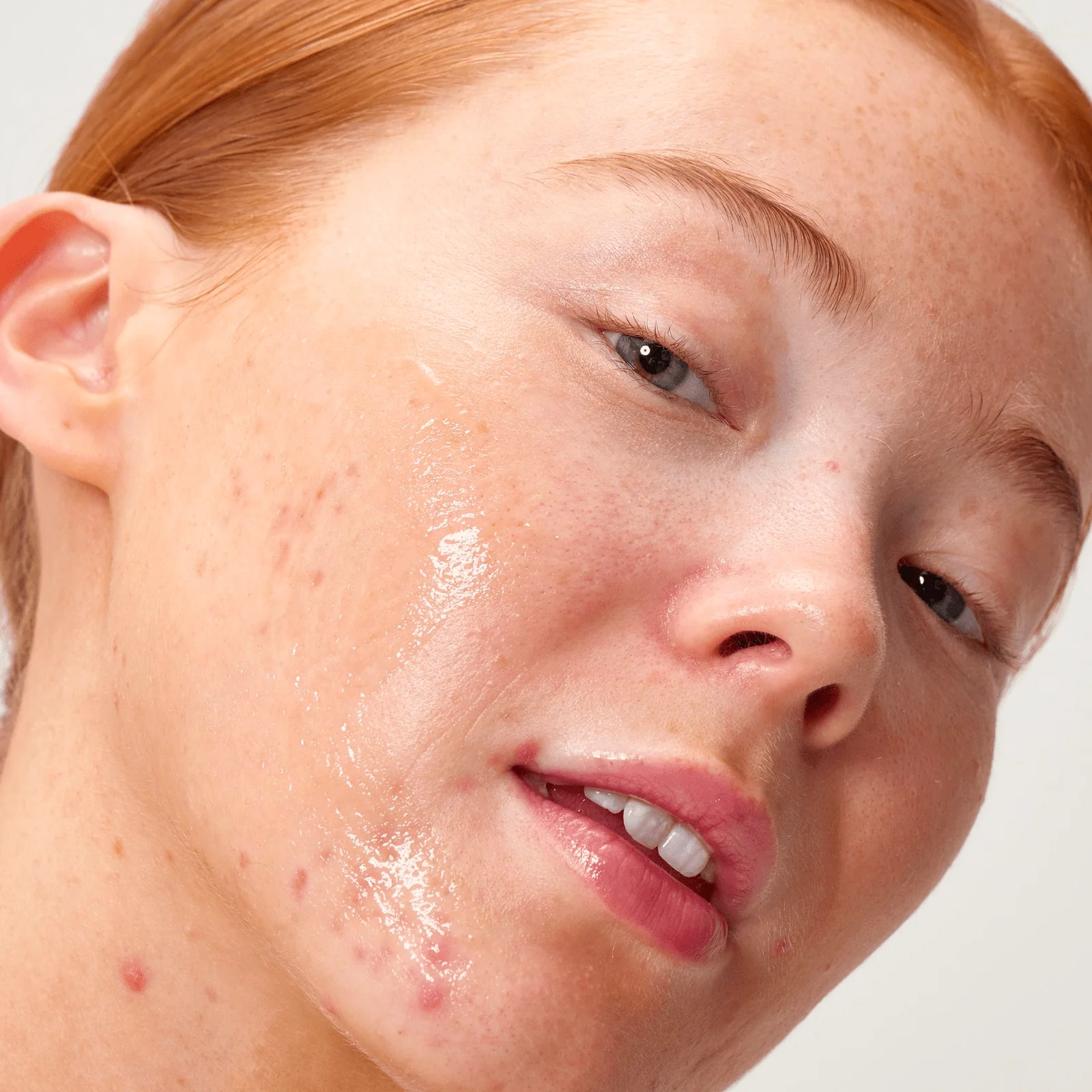 The Inkey List | Apple Cider Vinegar Acid Peel 30ml - Image 3