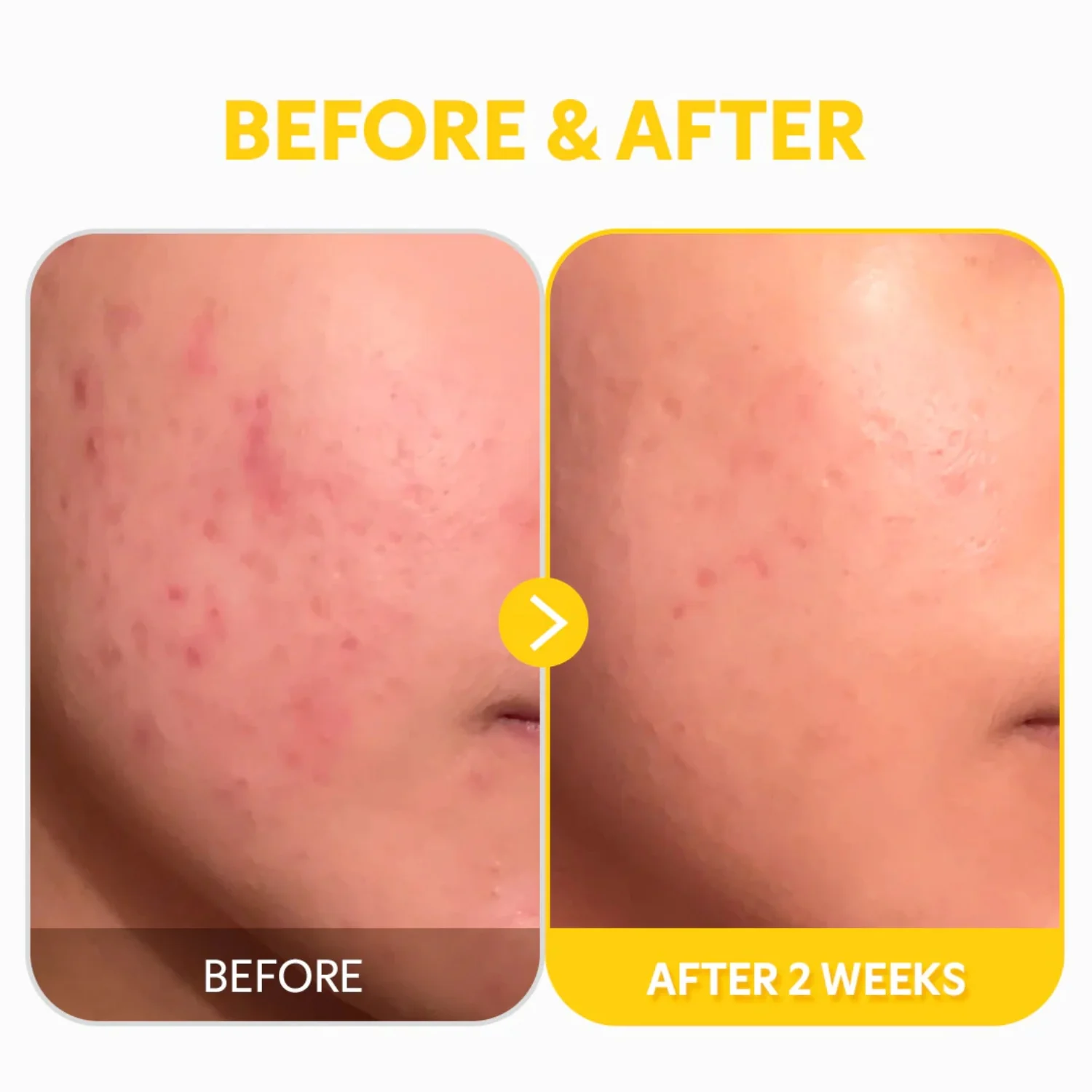 TIRTIR Pure Vitamin C24 Serum 30ml - Image 2