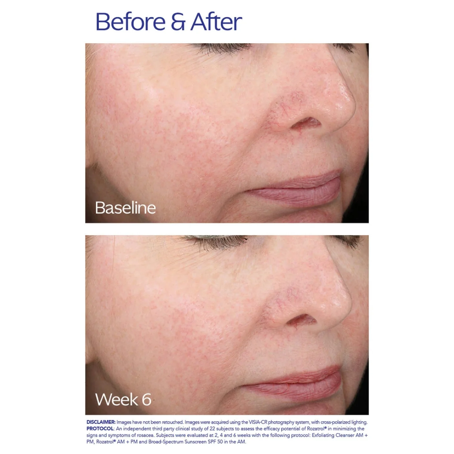 ZO Skin Health Rozatrol 50ml - Image 3